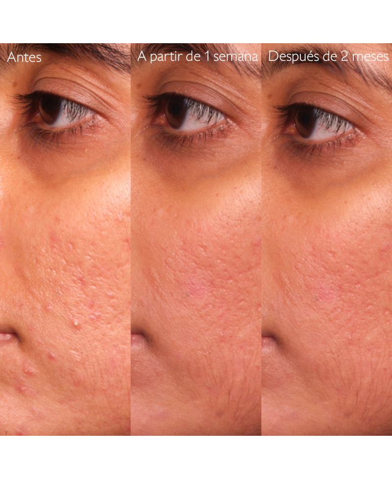 CAUDALIE Vinopure serum con salicilico anti-imperfecciones 30 ml