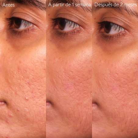 CAUDALIE Vinopure serum con salicilico anti-imperfecciones 30 ml