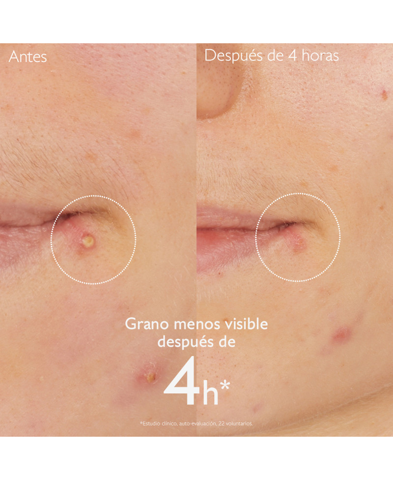 CAUDALIE Vinopure Stop Granos con ácido salicílico 15ml