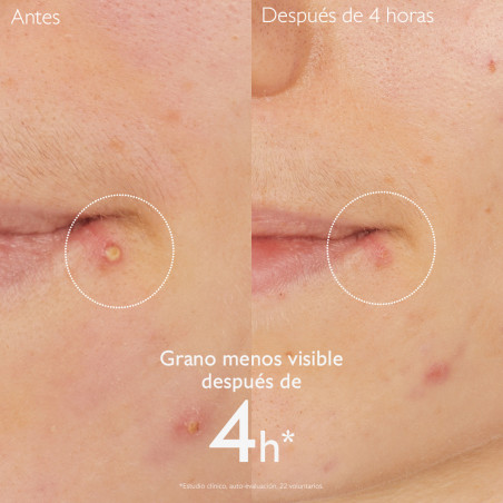 CAUDALIE Vinopure Stop Granos con ácido salicílico 15ml