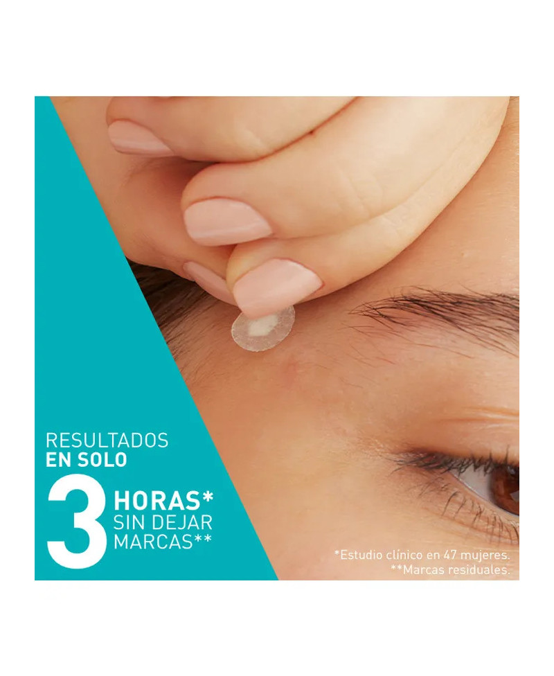 CERAVE Parches Control Imperfecciones 22 unidades